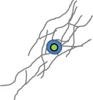 acidized well in a carbonate reservoir